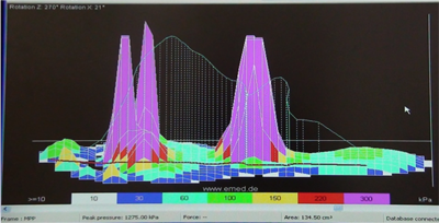 Pressure scan of foot