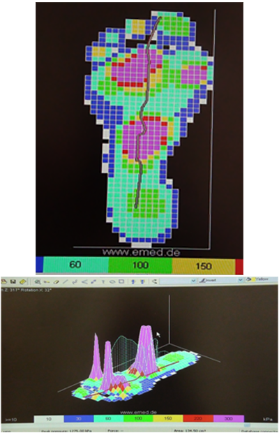 Computer scans of the foot