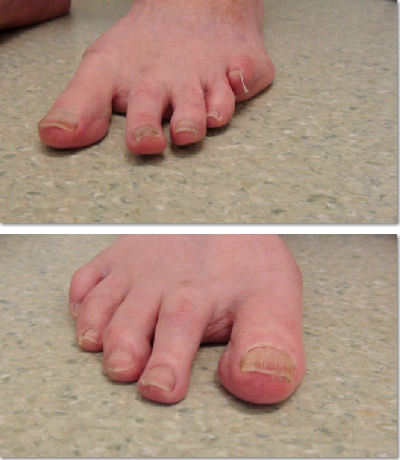 Patients feet