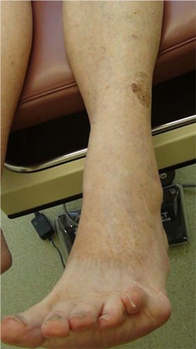 Examination of left leg